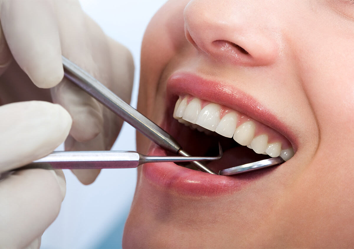 Teeth Whitening Dentist in Longmont CO Area